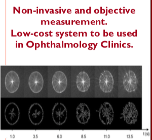 Non-invasive method to objectively determine the dynamics of the tear film and diagnose dry-eye disease (DED)