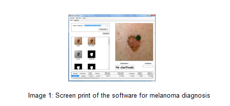 A decision support system for melanoma diagnosis.