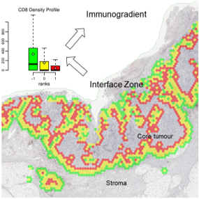 Automated Tumour-Stroma Interface Zone Detection for Anti-Tumour Response Assessment by Immunogradient Indicators